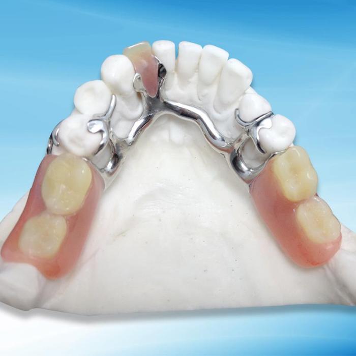 Partial dentures denture framework gums