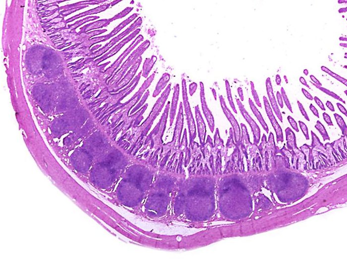 Related to part of the small intestine crossword